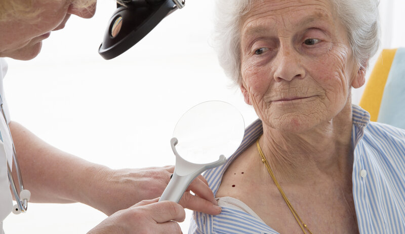 Rak skóry – dermatolog oglądający skórę starszej kobiety